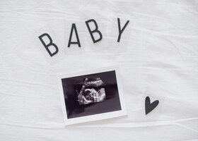 Free photo x ray photo of fetus on white sheets