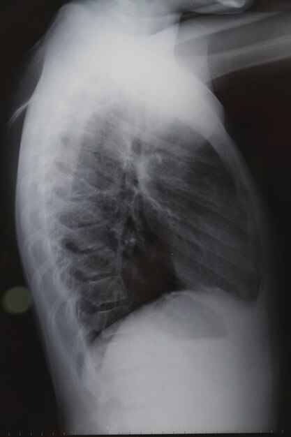 X ray scan of back