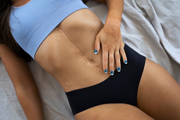 Free photo young adult with transgender scar
