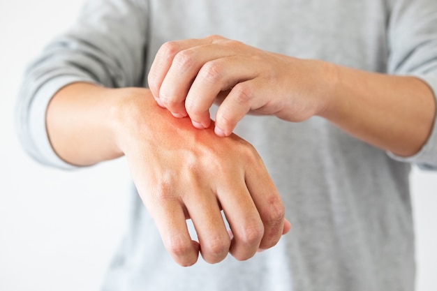 Premium Photo | Man having itchy and skin problem