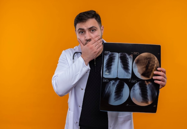 Молодой бородатый мужчина-врач в белом халате со стетоскопом держит в шоке рентгеновский снимок легких, прикрывая рот рукой