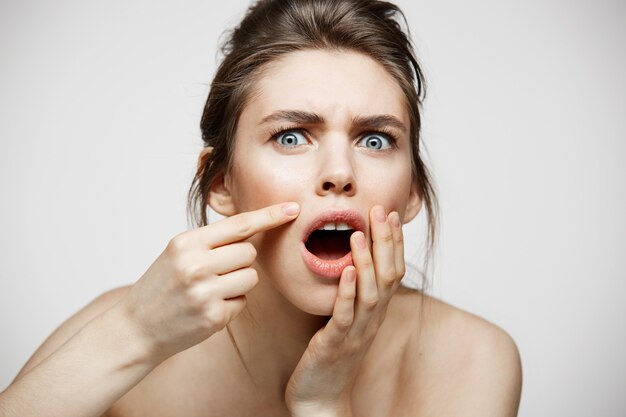 Young brunette girl displeased of her problem acne face skin over white background. Health cosmetology and skincare.