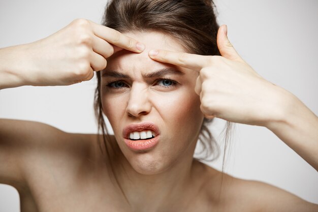 Young brunette girl displeased of her problem acne face skin over white background. Health cosmetology and skincare.