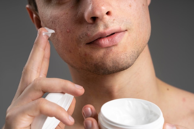 Free photo young handsome man using a cream for acne