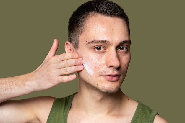 Young handsome man using a cream for acne