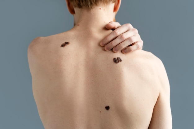 無料写真 黒色腫の背面図を持つ若い男