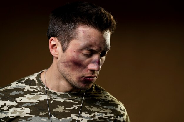 Young soldier affected by ptsd effect