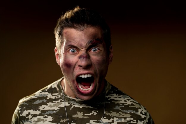 Молодой солдат под эффектом ptsd