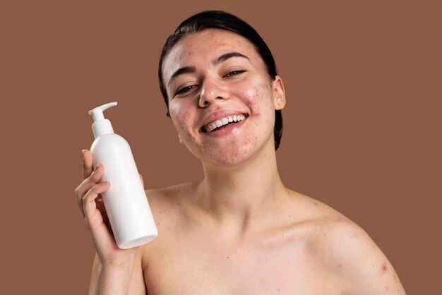 Young woman being confident with her acne