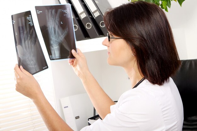 Young woman doctor is looking at xray