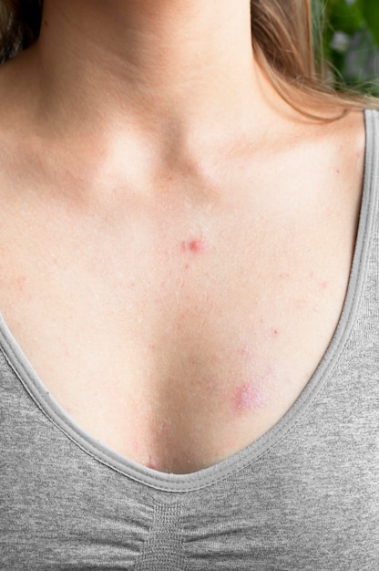 Young woman having skin allergy