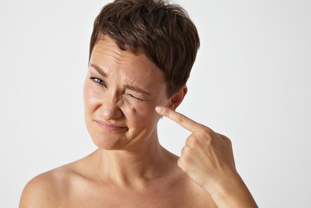 Young woman showing wrinkles around her eye