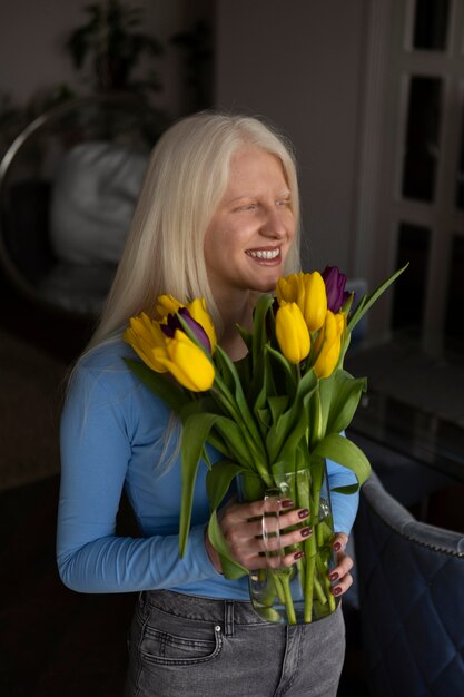 白皮症とチューリップの花を持つ若い女性