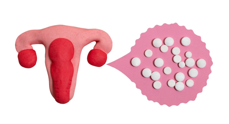Free PSD ovaries and uterus shape isolated
