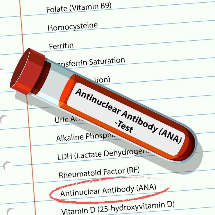 Free Vector antinuclear antibody test illustration