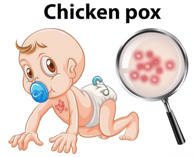 A baby with chicken pox Premium Vector