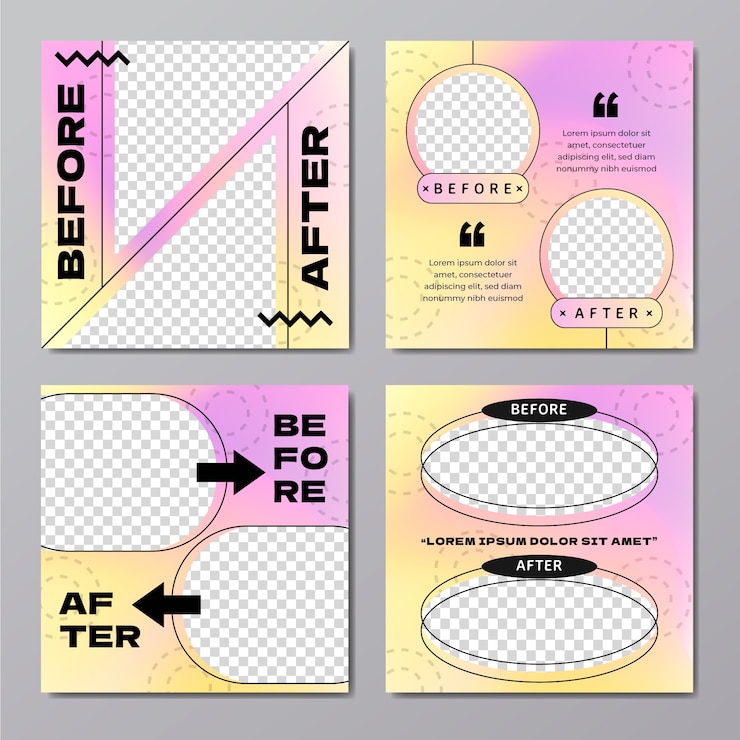 무료 Vector ig 포스트 수집 전후