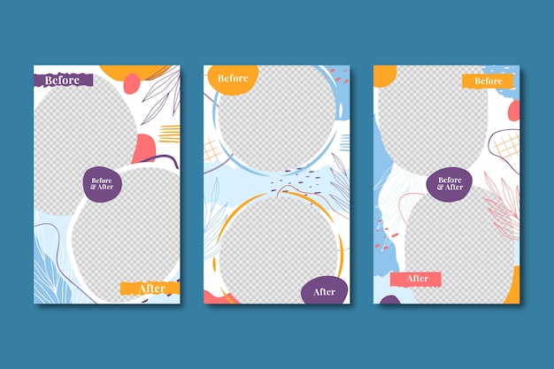 Vettore gratuito prima e dopo ig story collection