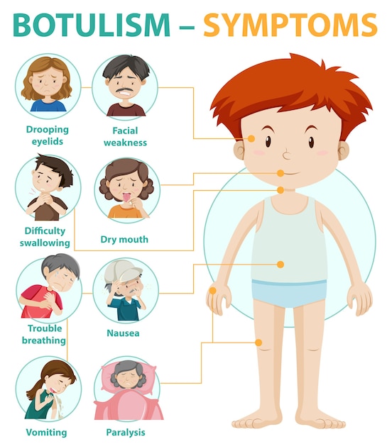 Infografica di informazioni sui sintomi di botulismo