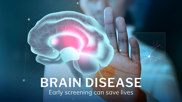Brain disease technology template