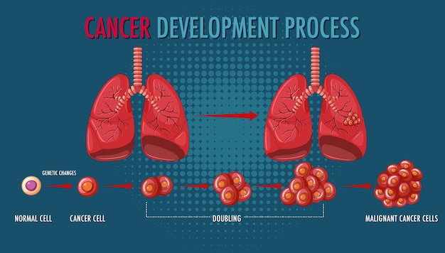 Vettore gratuito infografica sul processo di sviluppo del cancro