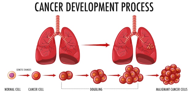 Free vector cancer development process infographic