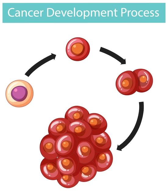 Free vector cancer development process infographic