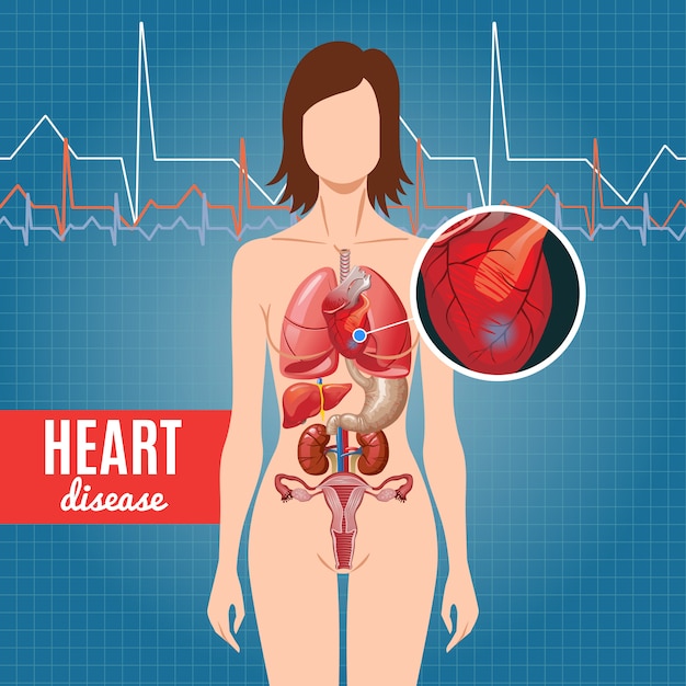 Free vector cartoon heart disease poster