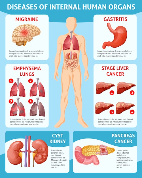 Cartoon medical care infographic concept