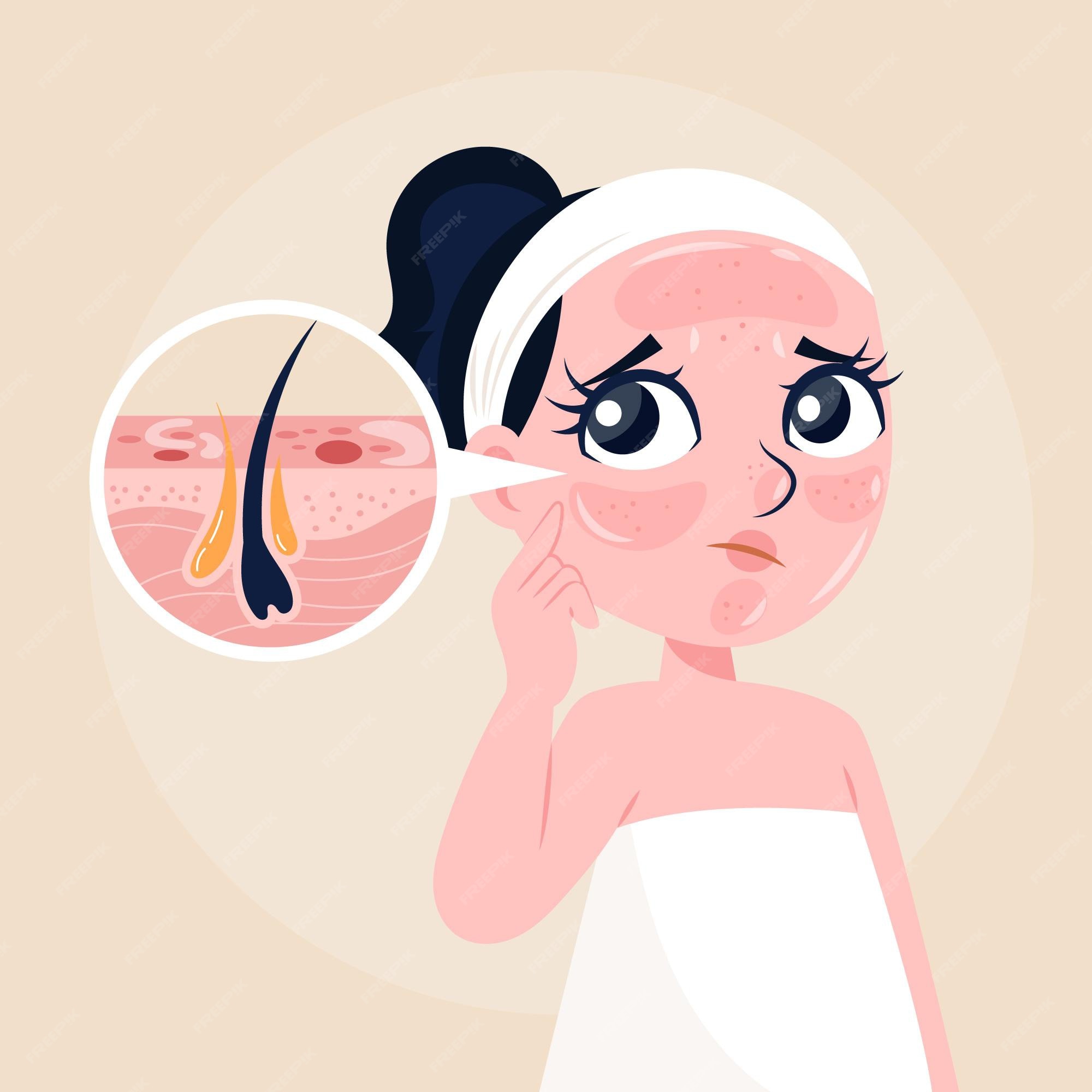 Free Vector | Cartoon oily skin concept Free Vector | Cartoon oily skin concept
