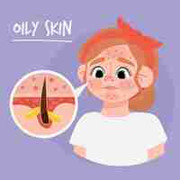 Free vector cartoon oily skin illustration with woman