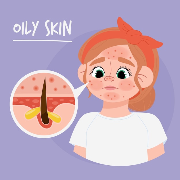 Cartoon oily skin illustration with woman