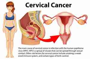 Free vector cervical cancer infographic with explanation