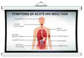 Free vector chart showing symptoms of acute hiv infection