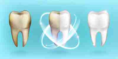 Vettore gratuito denti puliti e sporchi, sbiancamento o schiarimento dei denti