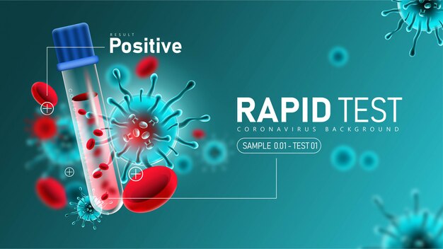 Экспресс-тест на коронавирус 2019 года с положительным результатом