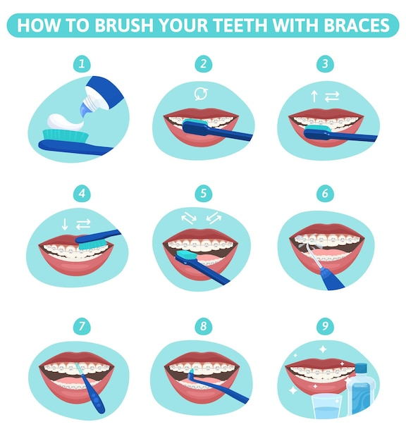 Free vector dental hygiene flat set of round infographic compositions showing mouth stages of teeth cleanup with braces vector illustration