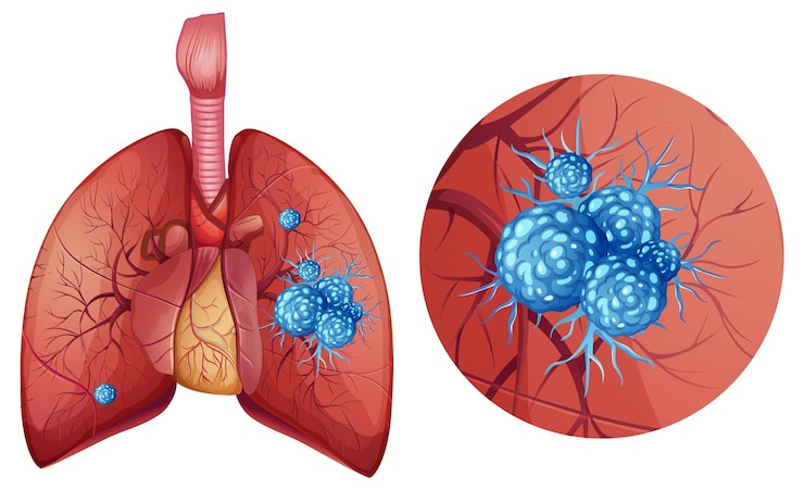 Free Vector detailed vector illustration of lung anatomy and cells