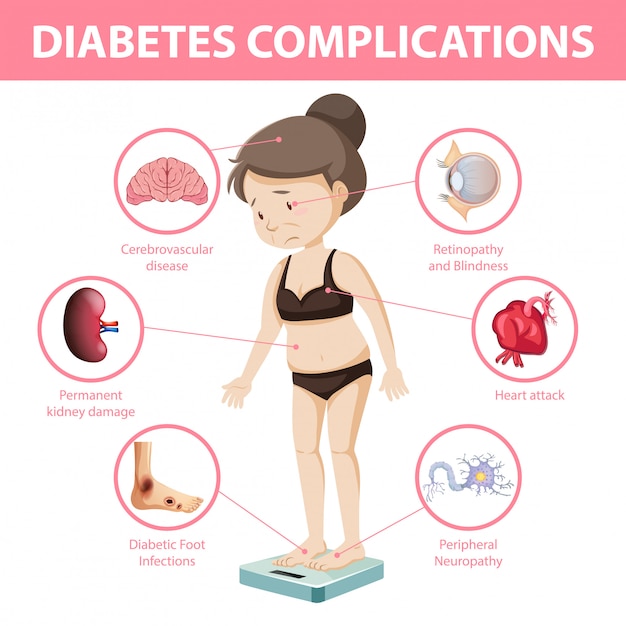 Infografica di informazioni sulle complicanze del diabete