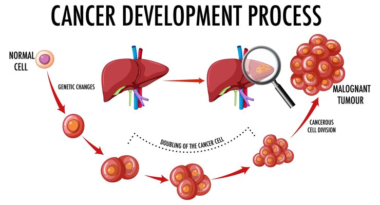 Free Vector diagram showing cancer development process