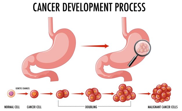 Диаграмма, показывающая процесс развития рака