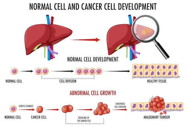 Free vector diagram showing cancer development process