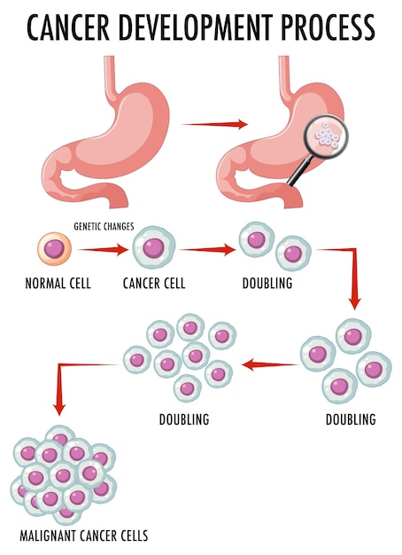 Vettore gratuito diagramma che mostra il processo di sviluppo del cancro