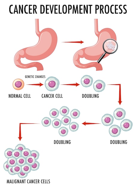 Диаграмма, показывающая процесс развития рака