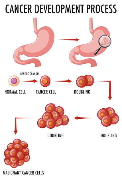 Diagram showing cancer development process