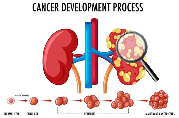 Diagram showing cancer development process