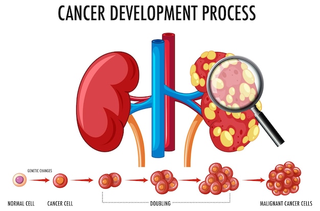 がんの発生過程を示す図