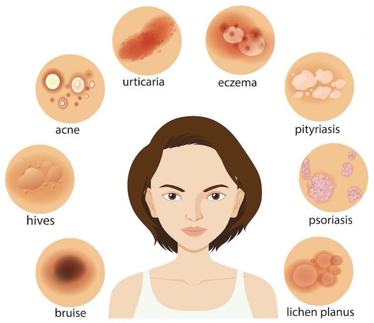 Free Vector diagram showing different skin conditions
