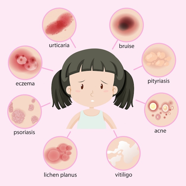 Vettore gratuito diagramma che mostra diversi tipi di malattia nel bambino