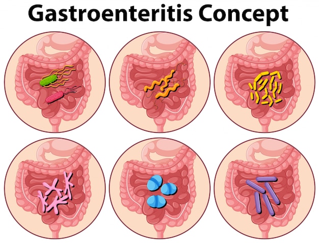 Vettore gratuito diagramma che mostra illustrazione di concetto di gastroenterite